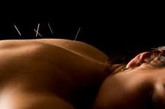 Acupuncture Mesa AZ