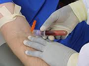 ALCAT Blood Testing in Arizona