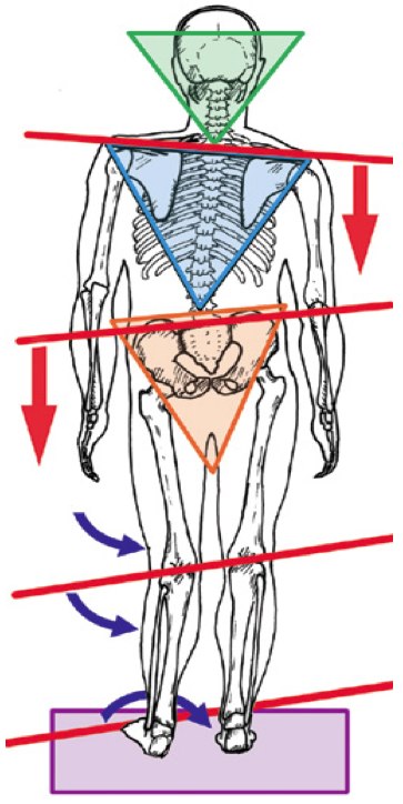 Back pain treatment